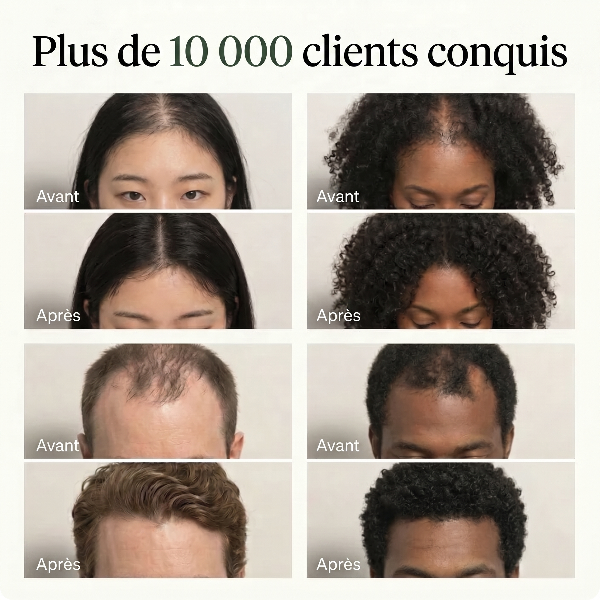 Barre Coréenne Cuir Chevelu